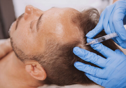 haarausfall-prp-therapie-klinik
